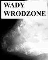 wady wrodzone